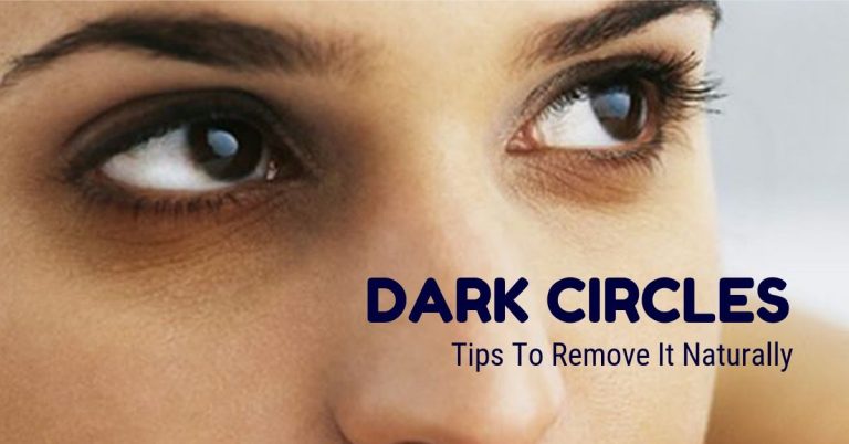 Best Tricks To Remove Dark Circles Under Your Eyes in Just 2 Days!