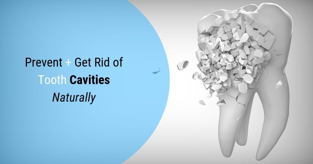 Prevent Tooth Cavities
