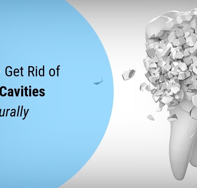 Prevent Tooth Cavities Doesn’t Have To Be Hard. Read These 15 Tips