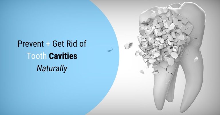 Prevent Tooth Cavities Doesn’t Have To Be Hard. Read These 15 Tips